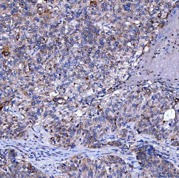 Anti-SUMF2 Antibody