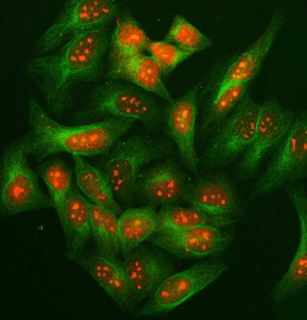 Anti-SUGT1 Antibody