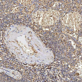 Anti-SUCLG2 Antibody