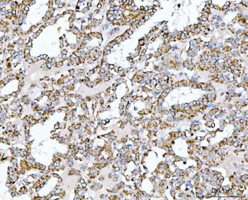Anti-SUCLG2 Antibody