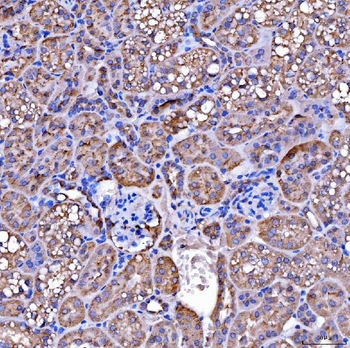 Anti-SUCLG2 Antibody