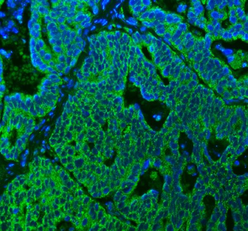 Anti-SUCLG2 Antibody