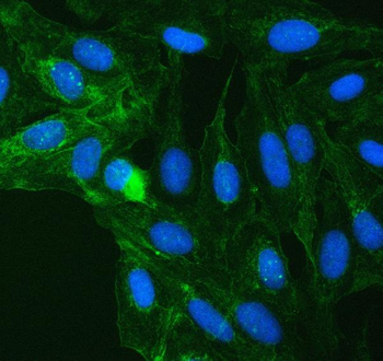 Anti-SUCLG2 Antibody
