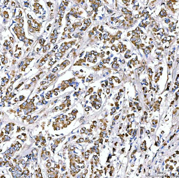 Anti-SUCLG2 Antibody