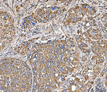 Anti-SUCLG2 Antibody