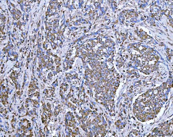 Anti-SUCLG2 Antibody