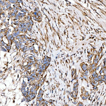 Anti-SUCLG2 Antibody