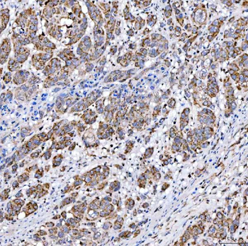 Anti-SUCLG2 Antibody