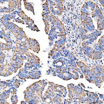 Anti-SUCLG2 Antibody