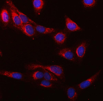 Anti-SUCLG1 Antibody
