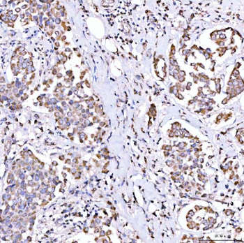 Anti-SUCLG1 Antibody