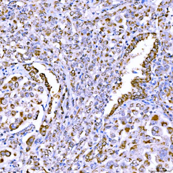 Anti-SUCLG1 Antibody