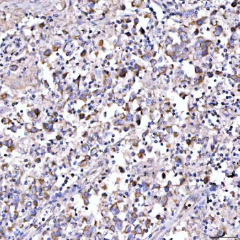Anti-SUCLG1 Antibody