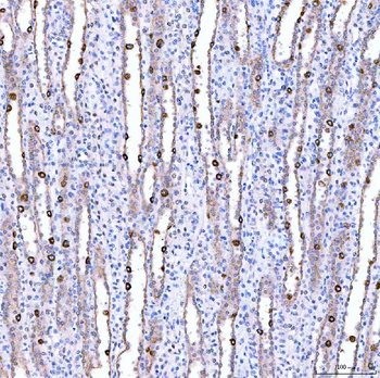 Anti-SUCLG1 Antibody