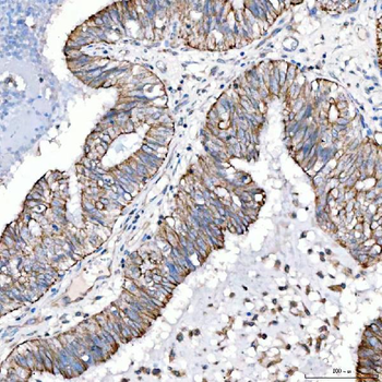 Anti-Cytokeratin 4/KRT4 Antibody