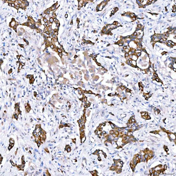 Anti-Cytokeratin 4/KRT4 Antibody