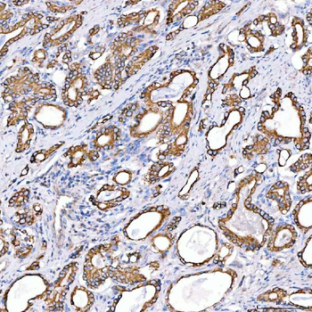 Anti-Cytokeratin 4/KRT4 Antibody