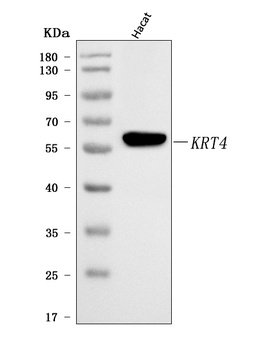 Cytokeratin 4/KRT4 Antibody