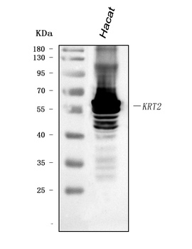 Cytokeratin 2e/KRT2 Antibody