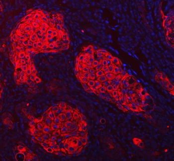 Anti-Cytokeratin 1/KRT1 Antibody