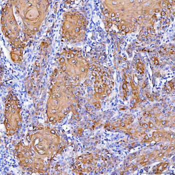 Anti-Cytokeratin 1/KRT1 Antibody