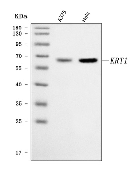 Cytokeratin 1/KRT1 Antibody