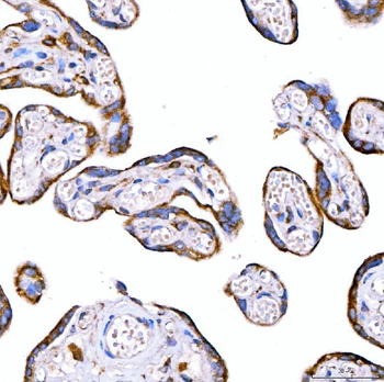 Anti-RAB7/RAB7A Antibody