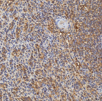 Anti-RAB7/RAB7A Antibody