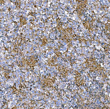 Anti-RAB7/RAB7A Antibody
