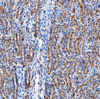 Anti-RAB7/RAB7A Antibody
