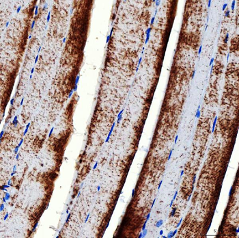 Anti-RAB7/RAB7A Antibody