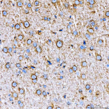 Anti-RAB7/RAB7A Antibody