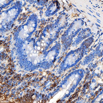 Anti-RAB7/RAB7A Antibody