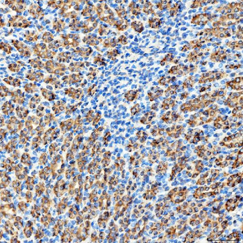 Anti-RAB7/RAB7A Antibody