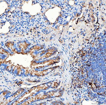 Anti-RAB7/RAB7A Antibody