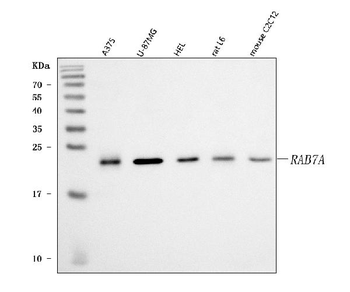 Anti-RAB7/RAB7A Antibody