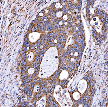Anti-RAB7/RAB7A Antibody