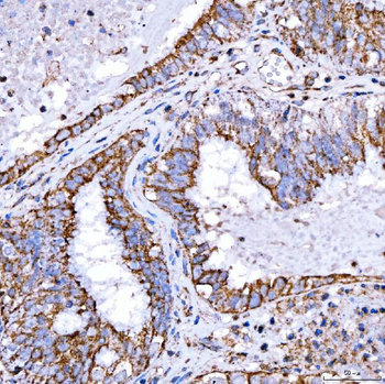 Anti-RAB7/RAB7A Antibody