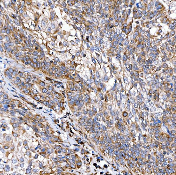 Anti-RAB7/RAB7A Antibody