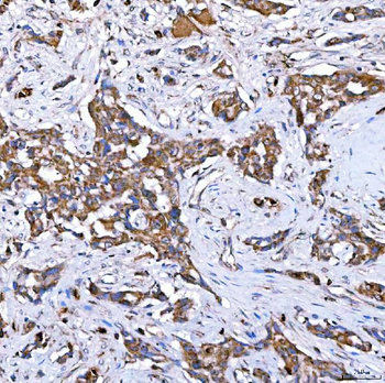 Anti-RAB7/RAB7A Antibody