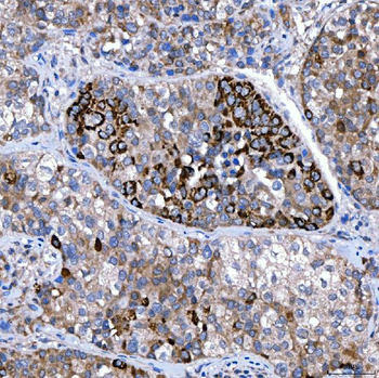 Anti-Rab4/RAB4A Antibody
