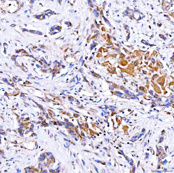 Anti-Rab4/RAB4A Antibody