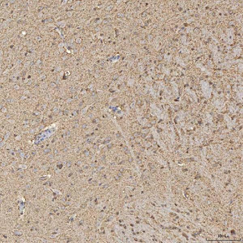 Anti-Synaptogyrin 3/SYNGR3 Antibody