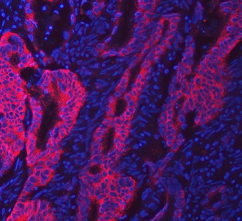 Anti-SWAP70 Antibody