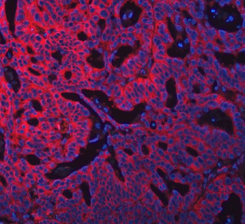 Anti-SWAP70 Antibody