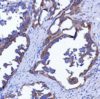 Anti-SWAP70 Antibody