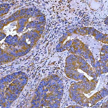 Anti-SWAP70 Antibody