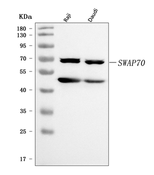 Anti-SWAP70 Antibody