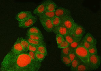 Anti-SA1/STAG1 Antibody