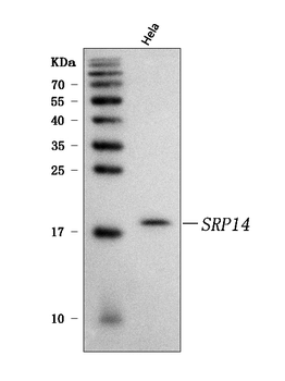 Anti-SRP14 Antibody